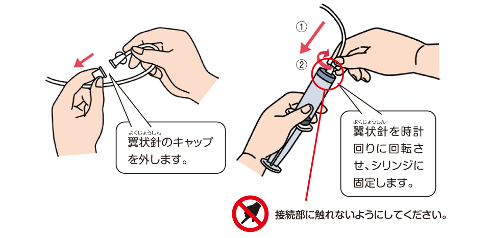 薬を入れたシリンジに翼状針を取りつけます。短い翼状針の場合、輸液チューブを接続します。