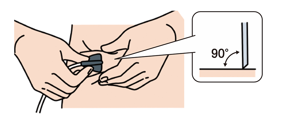 皮膚をつまみ、45°から90°の角度を目安に翼状針を一気に刺してください。針の注射角度については、主治医の指示に従ってください。