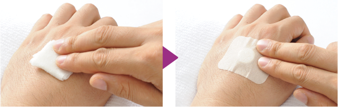 画像：完全に止血するまで（3〜5分）、アルコール綿で注射部位を押さえたままにします。止血を確認し、絆創膏を貼ります。